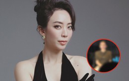 Diện mạo gây bàn tán của Thu Trang sau tai nạn phải khâu 20 mũi trên mặt