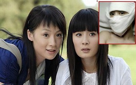 Ngọc nữ Trung Quốc tung ảnh phẫu thuật gọt mặt nhọn hoắt