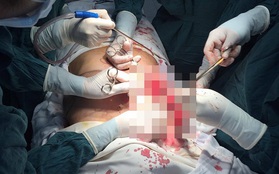 Lại thẩm mỹ hỏng: Nâng ngực sau sinh, con không thể bú còn mẹ phải phẫu thuật vì "chảy" silicon