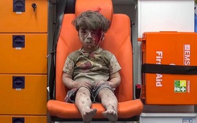 Nhiếp ảnh gia kể lại khoảnh khắc đau đớn khi chụp bức ảnh cậu bé Syria bị thương