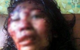 Bắc Giang: Chồng đánh đập vợ dã man như thời trung cổ
