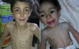 Cả thế giới bàng hoàng trước đoạn clip cho thấy nạn đói kinh hoàng ở Syria