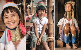 "Vườn thú người": nơi những người phụ nữ cổ dài Myanmar làm đồ trưng bày cho khách du lịch Thái Lan