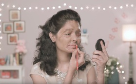 Cô gái với gương mặt biến dạng vì bị tạt axit sắp trở thành người mẫu tại tuần lễ thời trang New York