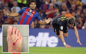 Suarez lớn tiếng dạy khôn dù đạp thủng chân đối thủ