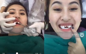 Tự livestream cảnh làm răng, Hà Lade khiến dân tình choáng nặng vì hai răng cửa mài bé tí
