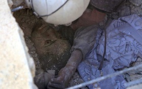 Gương mặt ám ảnh của cậu bé Syria bị chôn sống dưới đống đổ nát sau trận không kích