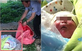 Gương mặt chi chít vết thương vì côn trùng cắn của đứa trẻ bị bỏ rơi dưới gầm cầu