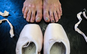Chùm ảnh: Đôi chân rướm máu của những thiên thần múa ballet