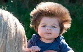 Bé trai 2 tháng tuổi đáng yêu sở hữu mái tóc "điện giật" bẩm sinh
