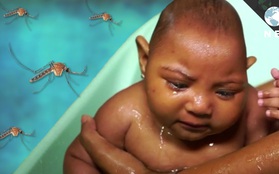 Thử nghiệm thành công 3 mẫu vaccine phòng chống virus Zika