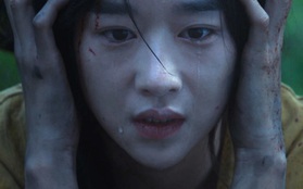 Nữ diễn viên Hàn Quốc bị bóng đè liên tục suốt 4 tháng quay phim