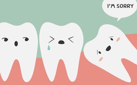 Tìm hiểu các triệu chứng khi mọc răng khôn để có cách đối phó tốt hơn