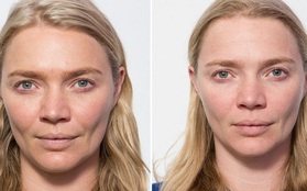 Siêu mẫu Jodie Kidd và cuộc thử nghiệm thức khuya: Chỉ trong 5 ngày mà da bị tàn phá khủng khiếp