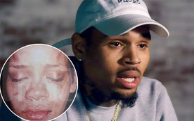 Chris Brown kể sự thật về đêm hành hung Rihanna bầm mặt: "Cô ấy đánh và nhổ máu vào mặt tôi"