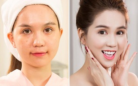 Da trắng mịn, sạch mụn, căng bóng - Công thức làm đẹp mới toanh đang gây "sốt"