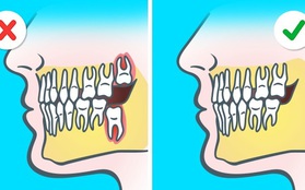 7 bằng chứng "rõ như ban ngày" cho thấy con người vẫn đang tiến hóa từng ngày