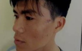 Nghệ An: Bị kiểm tra hành chính, nam thanh niên chửi bới, đấm vào mặt chiến sỹ công an