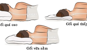 5 thói quen giới trẻ thường mắc phải gây ra chứng thiếu máu não nguy hiểm