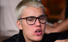 Justin Bieber cố tình để mặt "nở hoa" vì... bị nghiện nặn mụn?