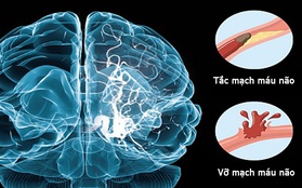 Người trẻ cũng cần cẩn thận với căn bệnh máu nhiễm mỡ đang ngày càng trẻ hóa