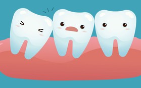 Đây là những cách để giảm sự hoành hành của chiếc "răng ngu"