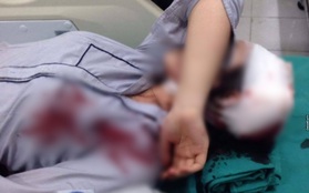 Nữ sinh lớp 10 ở Hà Nội bị bạn học đánh chấn thương sau giờ tan trường