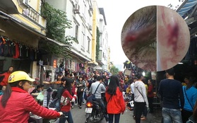 Hà Nội: Nữ sinh bị hành hung vì đi thử giày nhưng không mua ở chợ Nhà Xanh