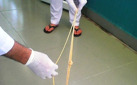 Rùng mình phát hiện sán xơ mít dài hơn 5m trong bụng cụ bà 82 tuổi ở Quảng Nam