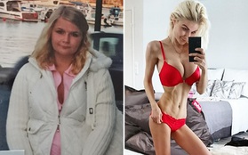 Hành trình giảm cân từ nàng béo thành búp bê Barbie suy dinh dưỡng
