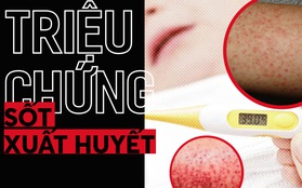 Dịch sốt xuất huyết đang ở ngay cạnh rồi: cần biết ngay các triệu chứng để phát hiện và chữa kịp thời