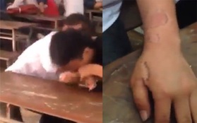 Clip: Thiếu niên cắn bạn gái chảy máu tay trong lớp học