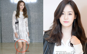 "Búp bê xứ Hàn" lộ chân như sắp gãy, đọ sắc bên mỹ nhân không tuổi Sung Yuri