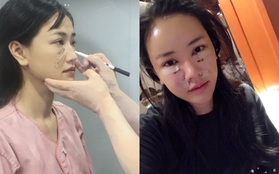 Maya tự tin khoe ảnh khuôn mặt vừa phẫu thuật thẩm mỹ tại Hàn Quốc