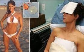 Bơm ngực quá to, người mẫu Playboy nằm liệt giường và suýt mất mạng