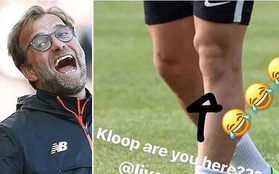 Trên đầu gối của Pato có gương mặt HLV Jurgen Klopp