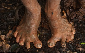 Bộ tộc người 6 ngón chân xòe kỳ lạ ở Mexico