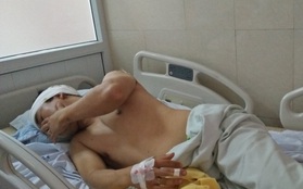 Hà Nội: Người đàn ông bị 2 thanh niên lạ mặt chém trọng thương tại sân chung cư cao cấp