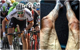 Tại sao đôi chân của các vận động viên đua xe đạp lại biến dạng khủng khiếp đến nhường này?