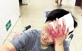 Phàn nàn về dịch vụ giao hàng, thực khách Trung Quốc bị hành hung chảy máu đầu