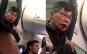 Clip gây sốc: Bác sĩ châu Á mặt đầy máu liên tục nói "Giết tôi đi" khi bị nhân viên hãng hàng không Mỹ thô bạo lôi khỏi máy bay