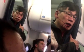 Sau vụ xô xát trên máy bay của United Airlines, tất cả hành khách đã bị đuổi xuống để nhân viên dọn sạch máu