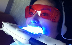 Chuyên gia bật mí ưu nhược điểm các phương pháp tẩy trắng răng phổ biến hiện nay