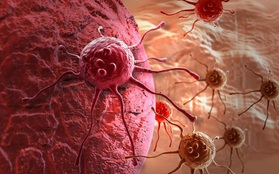 Đột phá y học của Nhật Bản: chỉ một lần thử, 13 loại ung thư được xác nhận