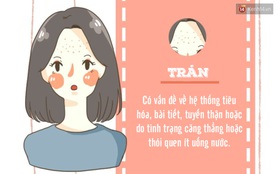 Nếu bạn đang có mụn, hãy kiểm tra ngay vị trí của chúng vì điều đó cũng nói lên các vấn đề sức khoẻ