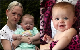 Qua bức ảnh gia đình, mẹ bàng hoàng phát hiện con gái 7 tháng tuổi mắc căn bệnh ung thư mắt cực hiếm gặp