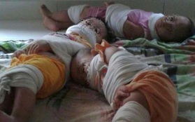 Hình ảnh 3 đứa trẻ bị trói chân tay, bịt miệng tại trường mầm non gây phẫn nộ