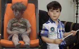 Cậu bé Syria mình đầy thương tích và bê bết máu sau một năm giờ thế nào?