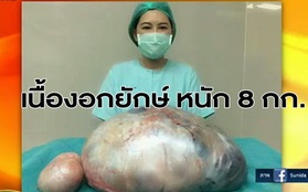 Tưởng béo phì, bệnh nhân đi khám và phát hiện ra khối u khổng lồ trong buồng trứng nặng 8kg