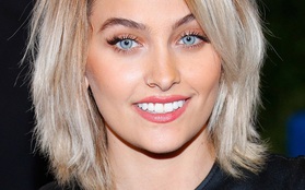 Ít ai biết, màu mắt xanh trong veo hút hồn của Paris Jackson thực chất là ảnh hưởng từ một căn bệnh hiếm